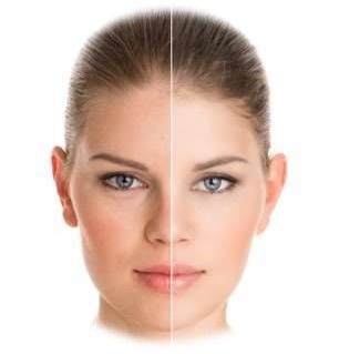 soin-visage-coup-eclat-domicile